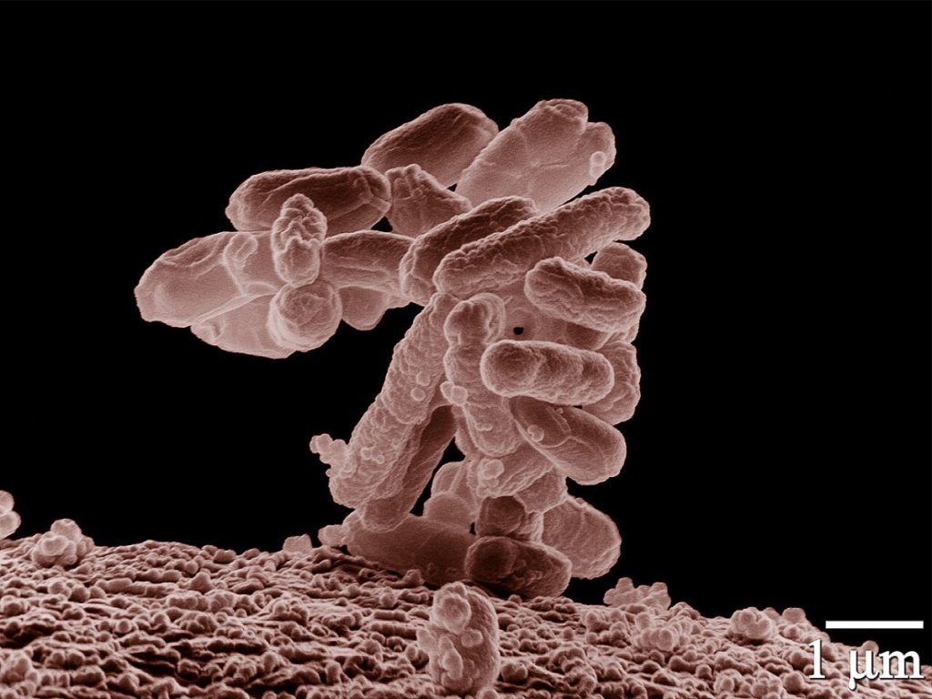 Escherichia coli al microscopio elettronico a scansione, ingrandimento diecimila volte